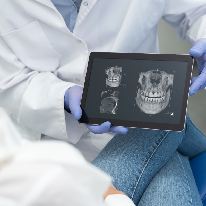 x-ray
